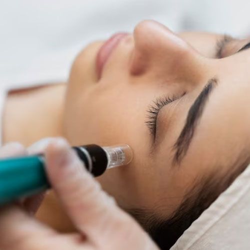 Microneedling