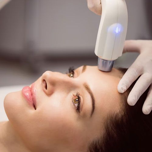 Laser for skin lightening